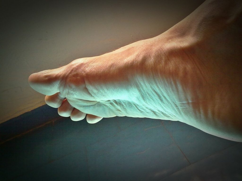 plantar fasciitis foot