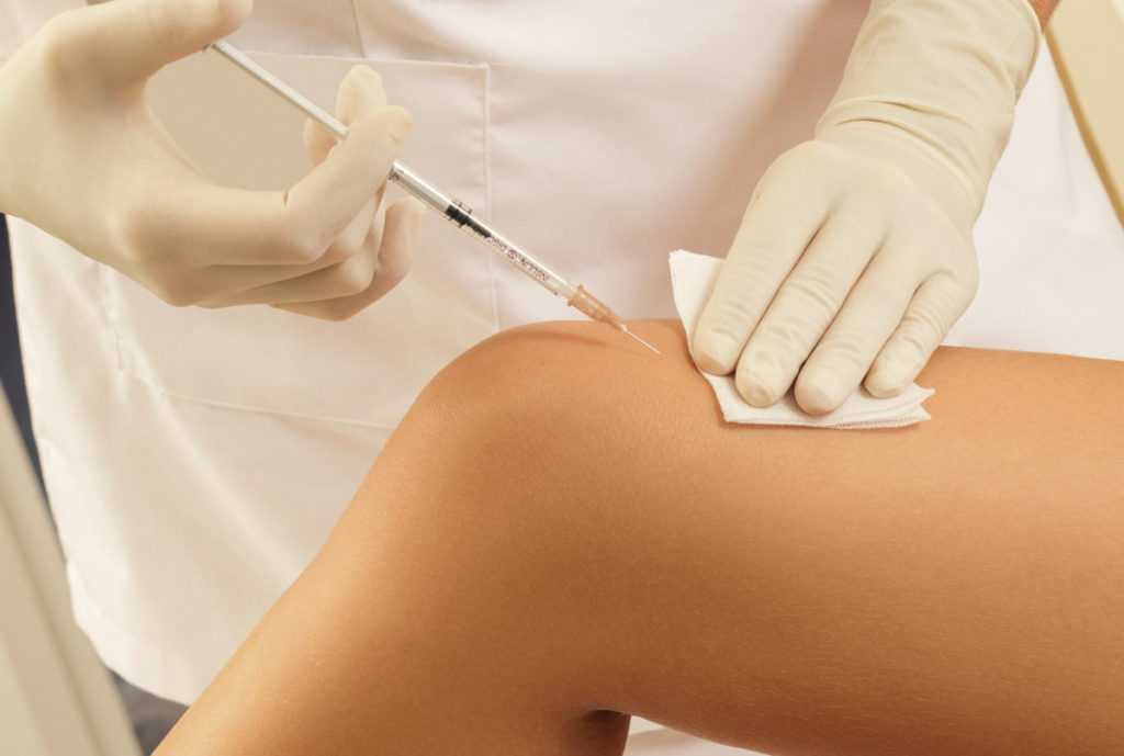 Woman receiving Botox treatment for knee pain