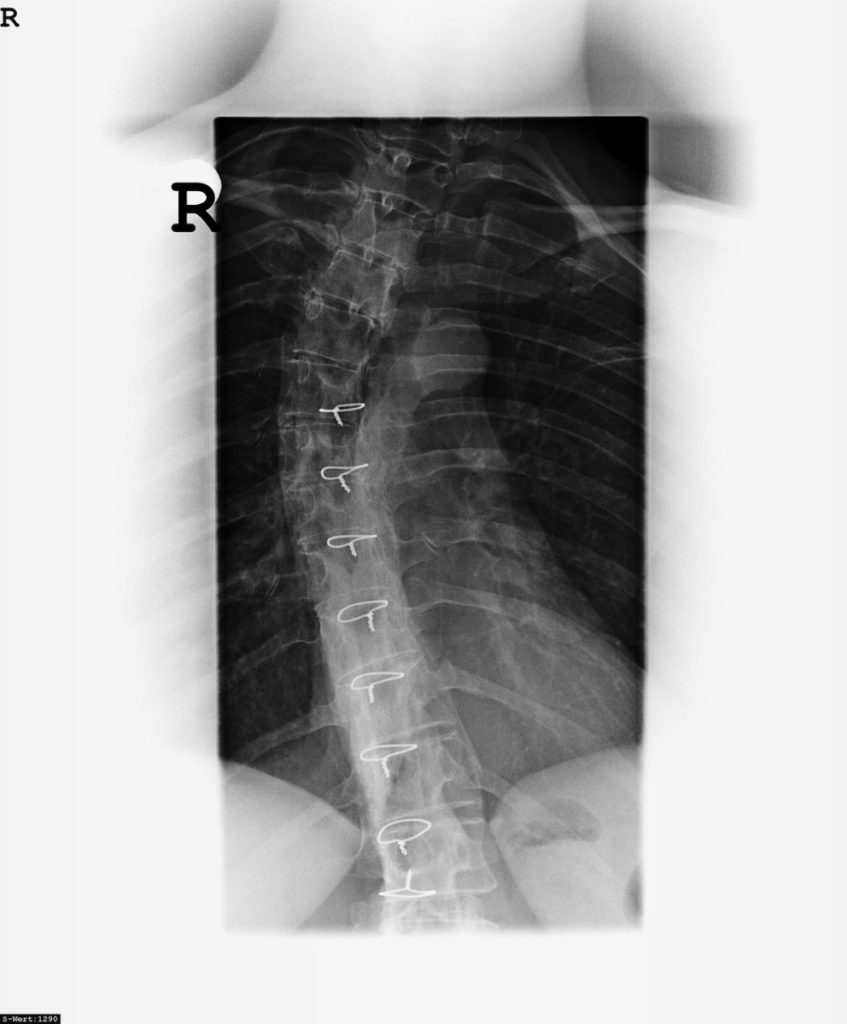 Orthopedists look at xrays of your skeletal system