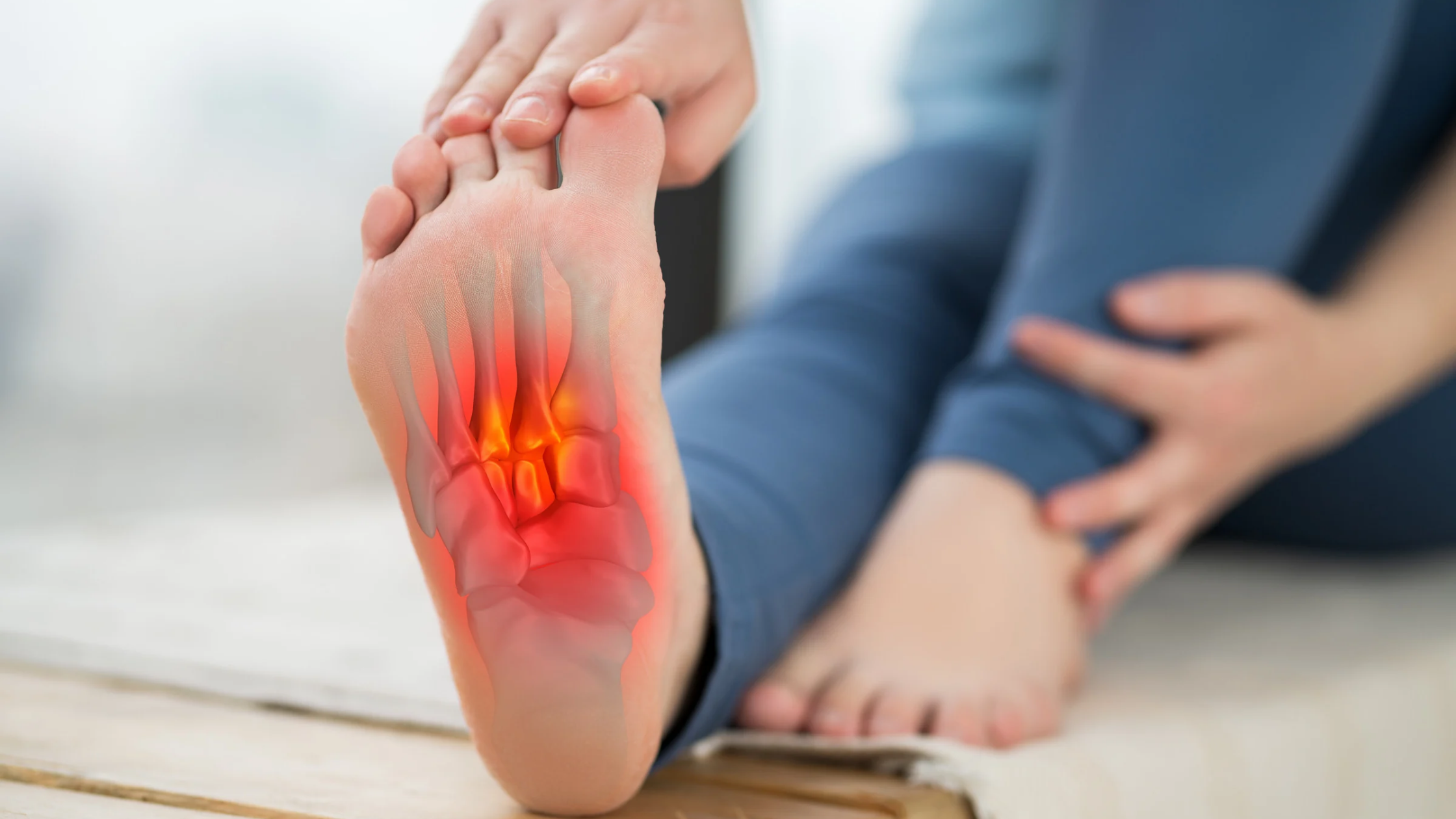 plantar fasciitis